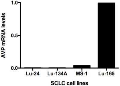 Inhibition of Ectopic Arginine Vasopressin Production by Phenytoin in the Small Cell Lung Cancer Cell Line Lu-165